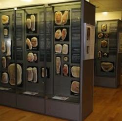 Moulagenmuseum des UniversitätsSpitals und der Uni