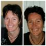 Lifting Facial Energétique - améliore la vitalité du corps, la qualité de la peau et votre rayonnement en général.