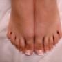 French Gel