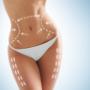 Gezielt abnehmen mit Lipolaser