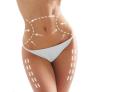 Lipolaser