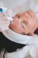 Microneedling & Nanoneedling – Hautregeneration in Erlenbach bei Zürich