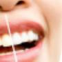 Bleaching
Dental Team Palace