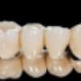 Kronen & Brücken
Dental Team Palace