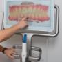 Abdruckfrei und ohne Würgereiz bei Kieferorthopädie Lyss