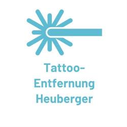 Tattoo-Entfernung Heuberger