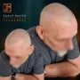 Micropigmentation capillaire résultat cicatrisé 5 ans avant retouche