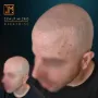 Tatouage capillaire résultat cicatrisé 6 mois