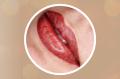 Lippen Permanent Make Up