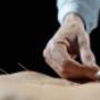 Sinomedica Agopuntura Medica e Medicina Tradizionale Cinese Chiasso