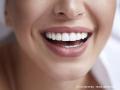 Dentalhygiene
