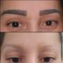 Microblading-Entfernung