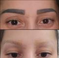 Microblading-Entfernung