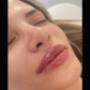 Meral Saglam - Médecin esthétique Genève - Lèvres