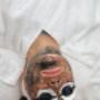 # 15