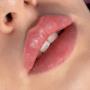 Lippen aufspritzen Zürich