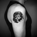 Tattooentfernung Gr: M-L : ab 169.- bis 290.-