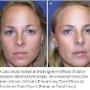 # 6