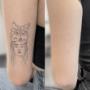 Tattooentfernung Schweiz