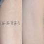 Tattooentfernung Schweiz