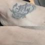 Tattooentfernung Schweiz