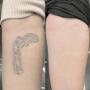 Tattooentfernung Schweiz