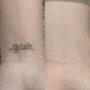 Tattooentfernung Schweiz