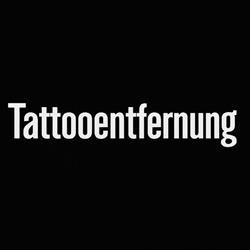 Tattooentfernung Schweiz