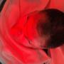 Rotes LED-Licht kurbelt die Kollagenproduktion an. Feine Linien können dadurch aufgepolstert und die Entstehung neuer Falten verlangsamt werden. Nebenbei regt die Behandlung mit rotem Licht die Durchblutung an und kann dadurch für einen frischeren Teint
