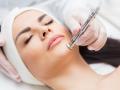 Diamant Mikrodermabrasion